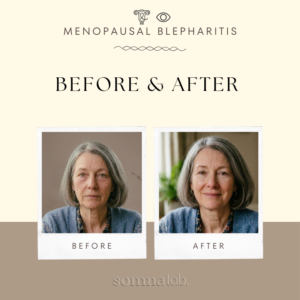 Somna Self-Heating Eye Therapy Mask