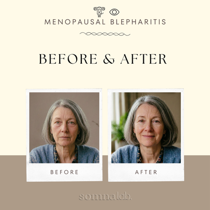 Somna Self-Heating Eye Therapy Mask